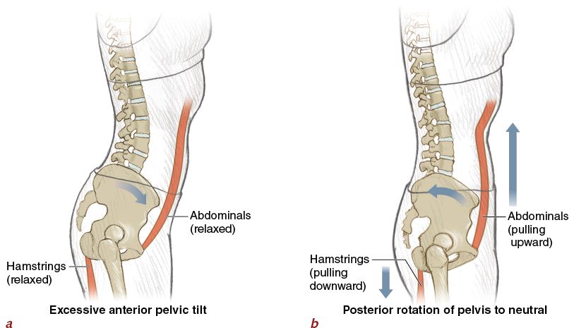 How to Improve Bad Posture With Exercise